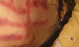 扯痧视频,传统养生新体验